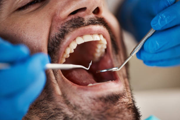 Best Emergency Dental Care for Sports Injuries in Farley, KY
